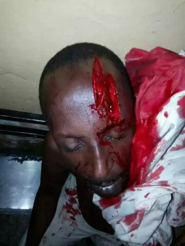 Militants Attack Legendary Hausa Movie Producer & Actor Sheriff Ahlan(Graphic Photos)